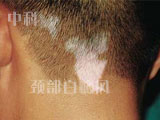 пưҽԺ