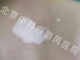 пưҽԺ