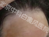пưҽԺ